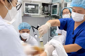 Các bác sĩ thực hiện thủ thuật rút nước ối cho sản phụ.