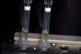 Hai mẫu bệnh phẩm nghi ngờ nhiễm virus đậu mùa khỉ đang trong quá trình xét nghiệm tại phòng thí nghiệm vi sinh, Bệnh viện La Paz, Madrid, Tây Ban Nha, ngày 1/6/2022. (Ảnh: Reuters)