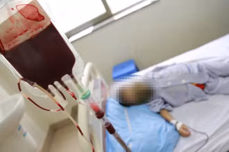 Bệnh nhi thalassemia phải truyền máu định kỳ. 