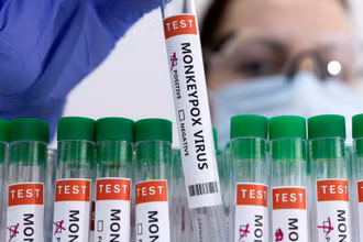 Ống xét nghiệm bệnh đậu mùa khỉ. (Ảnh: Reuters)