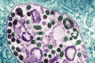 Hình ảnh dưới kính hiển vi điện tử của virus Marburg. (Ảnh: BSIP/UIG/Getty Images)