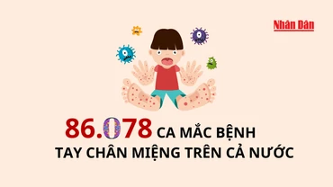 [Infographic] 86.078 ca mắc bệnh tay chân miệng trên cả nước