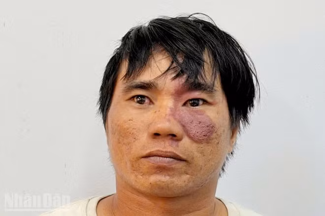 Bị can Lê Công Bằng.