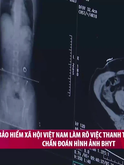 [Video] Bảo hiểm xã hội Việt Nam làm rõ việc thanh toán dịch vụ chẩn đoán hình ảnh BHYT