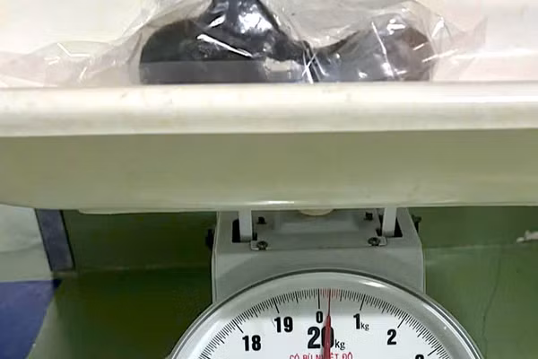 Khối tóc sau khi được lấy ra từ dạ dày bé Y và được cân kiểm tra. (Ảnh: Bệnh viện Sản-Nhi Cà Mau cung cấp)