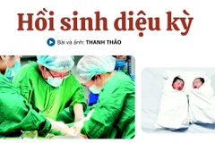 Hồi sinh diệu kỳ
