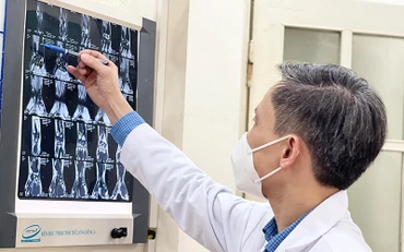 PGS,TS Nguyễn Mạnh Khánh xem hình ảnh MRI của bệnh nhân trước khi tiến hành phẫu thuật nội soi. 