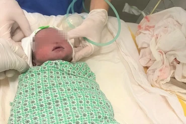 Một bé trai chào đời kỳ diệu tại bệnh viện Phụ sản Hà Nội