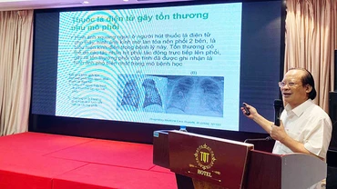 Hút thuốc lá điện tử là nguyên nhân gây nhiều nguy hại với sức khỏe.