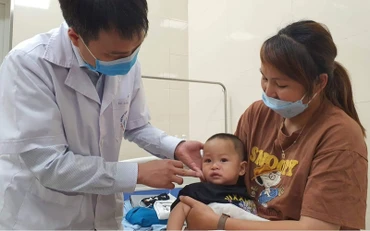 Các bác sĩ khám, đánh giá sau phẫu thuật cho trẻ bị khe hở môi-vòm miệng.