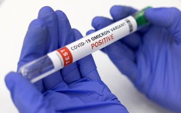 Pháp ghi nhận sự gia tăng các trường hợp dương tính với virus Sars-CoV-2. (Ảnh: REUTERS)