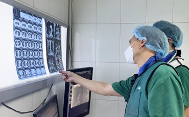 Các bác sĩ khoa Chẩn đoán hình ảnh hội chẩn trước can thiệp cho bệnh nhân.