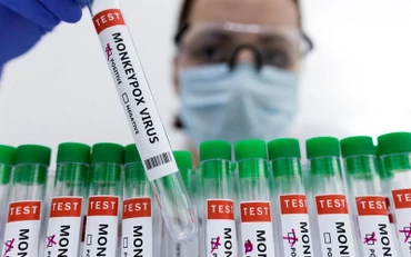 Các ống nghiệm dán nhãn "dương tính với virus đậu mùa khỉ". (Ảnh minh họa: REUTERS)