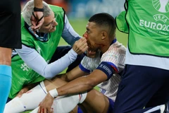 [Ảnh] Gặp chấn thương mũi, Kylian Mbappé để ngỏ khả năng ra sân trận tiếp theo