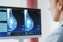 Công nghệ AI cho thấy tính chính xác trong chẩn đoán bệnh. Ảnh: HEALTHCARE