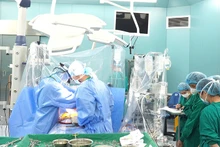 Kíp phẫu thuật thực hiện thay van tim cho bệnh nhân Nguyễn Thị Hùng.