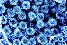 Hình ảnh từ kính hiển vi virus SARS-CoV-2 trong mẫu bệnh phẩm của bệnh nhân mắc Covid-19. (Ảnh: AFP/TTXVN)