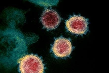 Ảnh minh họa: Virus SARS-CoV-2