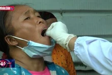 Kiểm soát chặt chẽ nguồn lây các ca bệnh bạch hầu