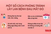 Một số cách phòng tránh lây lan bệnh đau mắt đỏ