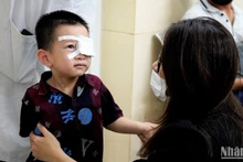 Bệnh nhi được bóc giả mạc tại Bệnh viện Nhi Trung ương. (Ảnh: THẾ KHẢI)