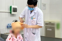 Bệnh nhi bị chó nhà cắn vào vùng đầu mặt.