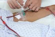 Bệnh nhân rơi vào tình trạng suy thận tiến triển vì tự điều trị bằng thuốc nam.