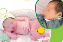 Bé gái chào đời nặng 2.150g.