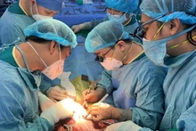 Bệnh viện Nhi Đồng 2 Thành phố Hồ Chí Minh thực hiện ghép gan trở lại. (Ảnh: Bệnh viện cung cấp).
