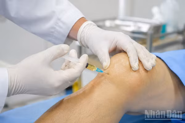 Cẩn trọng trong việc sử dụng tế bào gốc điều trị khớp gối