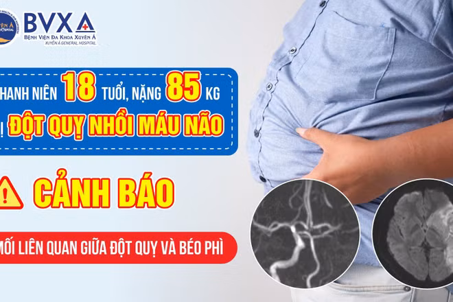 Ảnh minh họa. (Bệnh viện cung cấp)