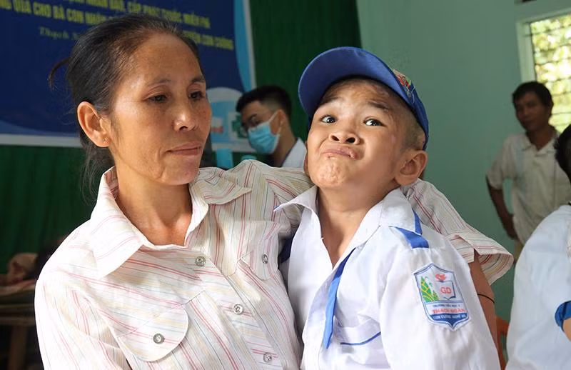 Chị Vi Thị Thủy (46 tuổi) cõng con trai là cháu Lô Kim Chi (13 tuổi) bị tật bẩm sinh đến Nhà văn hóa bản Thạch Sơn đã được bác sĩ khám chu đáo. Chị Thủy hết sức cảm kích khi con mình được các y bác sĩ thăm khám, chuẩn đoán bệnh, phát thuốc miễn phí.