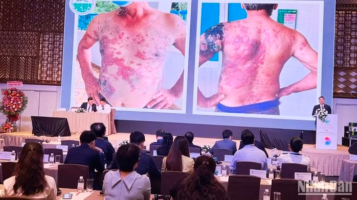 Các chuyên gia trình bày một ca bệnh lý về da với các đại biểu dự hội nghị