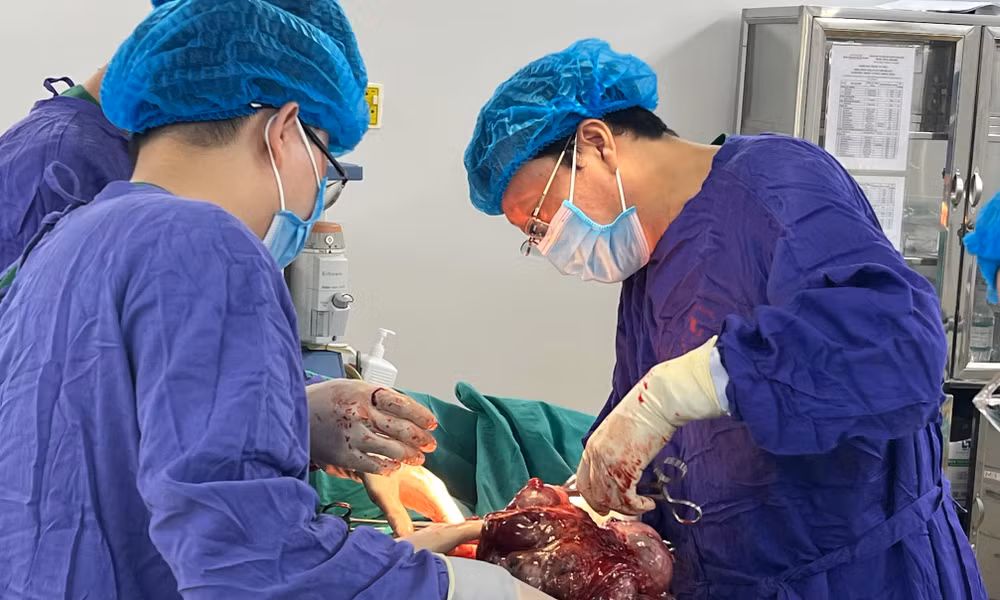 Khối u nặng hơn 7kg được lấy ra khỏi ổ bụng người bệnh. Khối u nặng hơn 7kg được lấy ra khỏi ổ bụng người bệnh.
