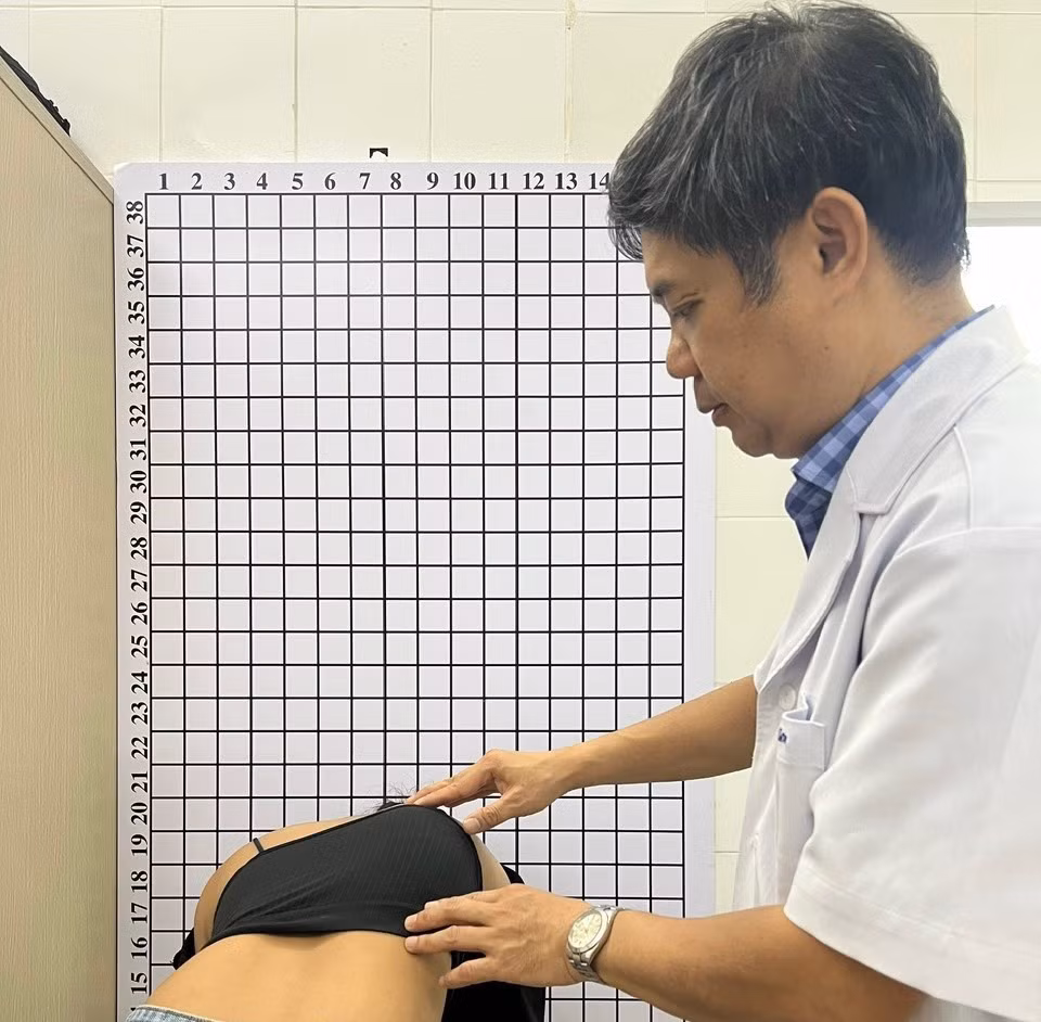 PGS.TS Đinh Ngọc Sơn, Trưởng khoa Phẫu thuật Cột sống, Bệnh viện Hữu nghị Việt Đức khám gù vẹo cột sống cho trẻ em.