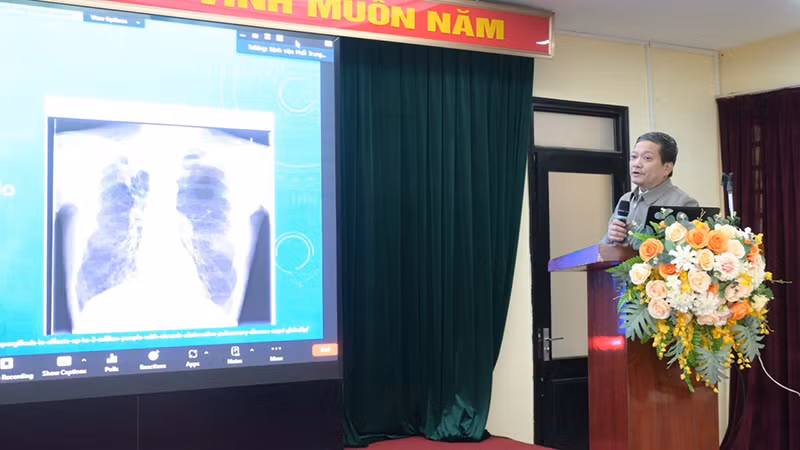 Tiến sĩ, bác sĩ cao cấp Đinh Văn Lượng, Giám đốc Bệnh viện Phổi Trung ương chia sẻ về bệnh nấm phổi.