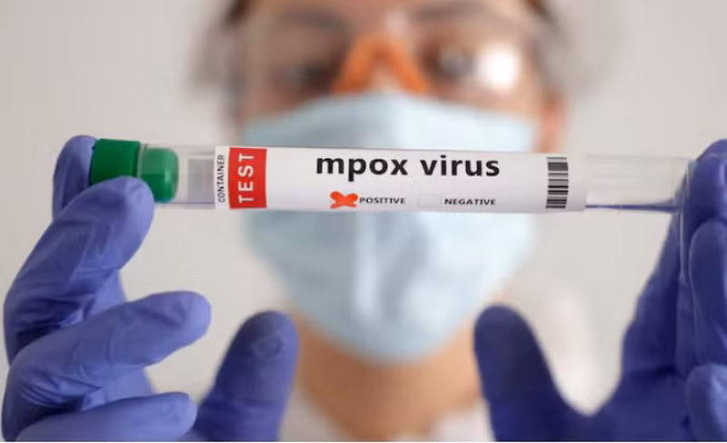 Nhiều nước ở châu Phi cũng không có đủ trang thiết bị cần thiết để theo dõi và giám sát dịch bệnh. (Nguồn: Reuters) Nhiều nước ở châu Phi cũng không có đủ trang thiết bị cần thiết để theo dõi và giám sát dịch bệnh. (Nguồn: Reuters)