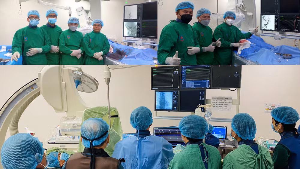 Công tác điều trị đột quỵ ở An Giang có những chuyển biến tích cực nhờ chiến lược đầu tư đồng bộ, khoa học. Công tác điều trị đột quỵ ở An Giang có những chuyển biến tích cực nhờ chiến lược đầu tư đồng bộ, khoa học.