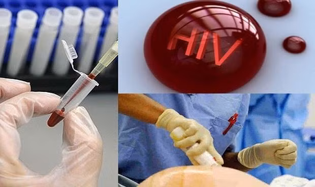 Điều kiện xác định người bị phơi nhiễm HIV, người bị nhiễm HIV do tai nạn rủi ro nghề nghiệp. (Ảnh: chinhphu.vn)