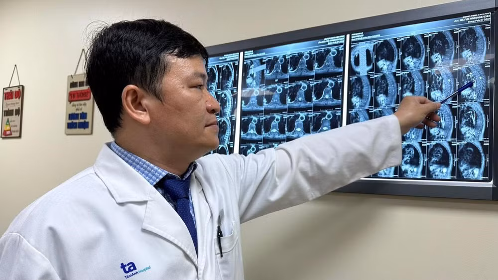 Bác sĩ Bảo Ngọc đang xem xét khối u của ông L. nằm trọn trong ống sống ngực. 
