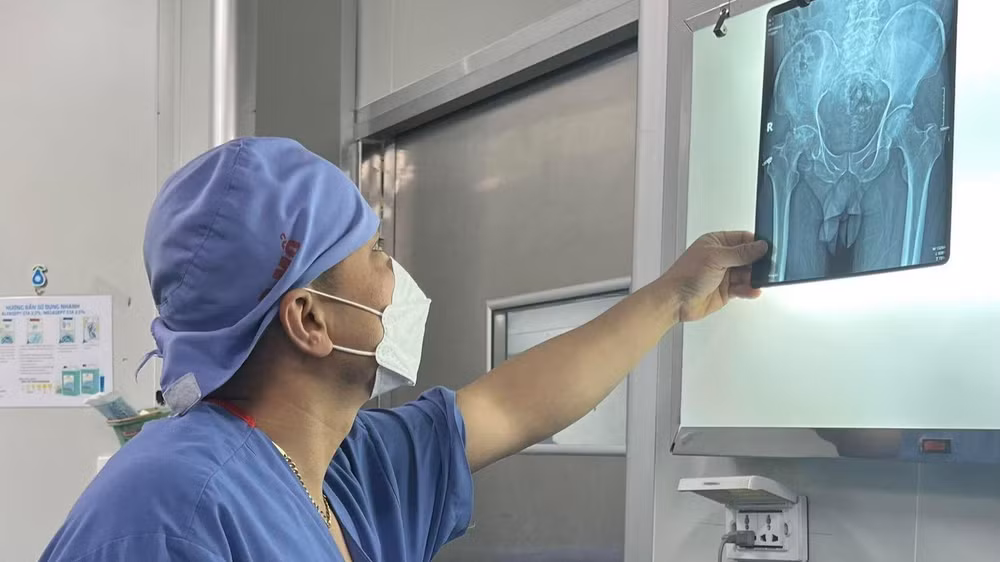 Nhiều người trẻ đang trong độ tuổi lao động bị hoại tử chỏm xương đùi. Nhiều người trẻ đang trong độ tuổi lao động bị hoại tử chỏm xương đùi.