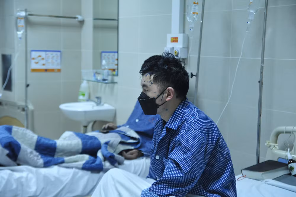 Nhiều người lớn mắc bệnh thủy đậu trái mùa.