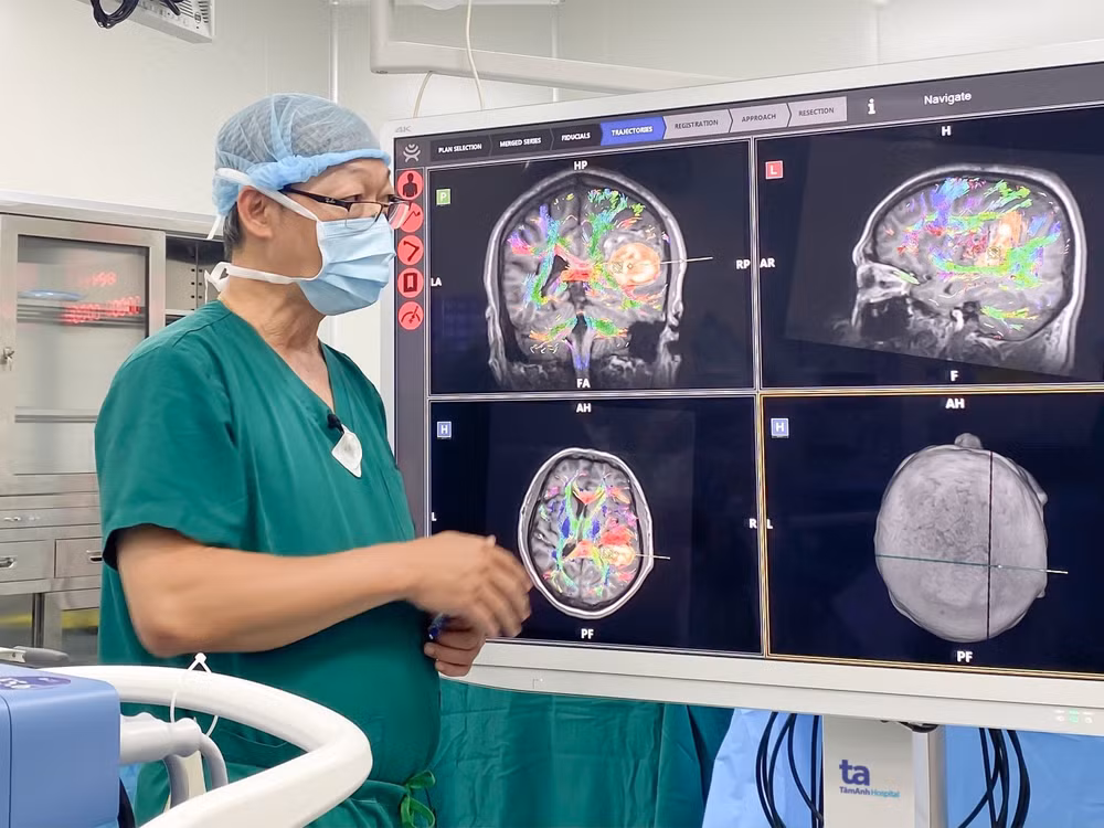 Robot AI hòa hình MRI, DTI.. cho thấy rõ các bó sợi thần kinh và khối máu tụ chèn ép trong não người bệnh.