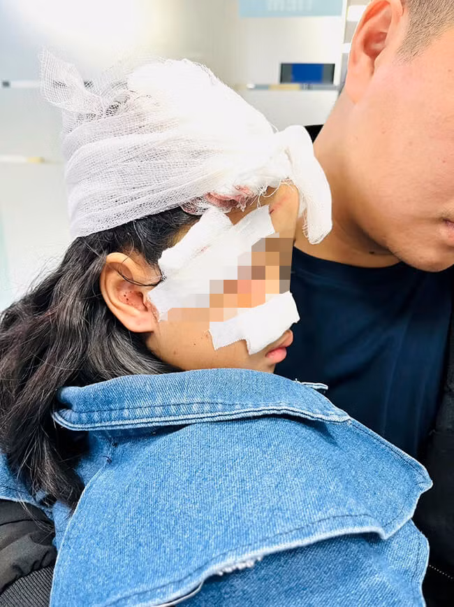Bệnh nhi nhập viện trong tình trạng có nhiều vết thương vùng mặt và đầu do bị chó cắn. Bệnh nhi nhập viện trong tình trạng có nhiều vết thương vùng mặt và đầu do bị chó cắn.
