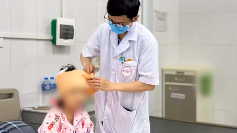 Bệnh nhi bị chó nhà cắn vào vùng đầu mặt.