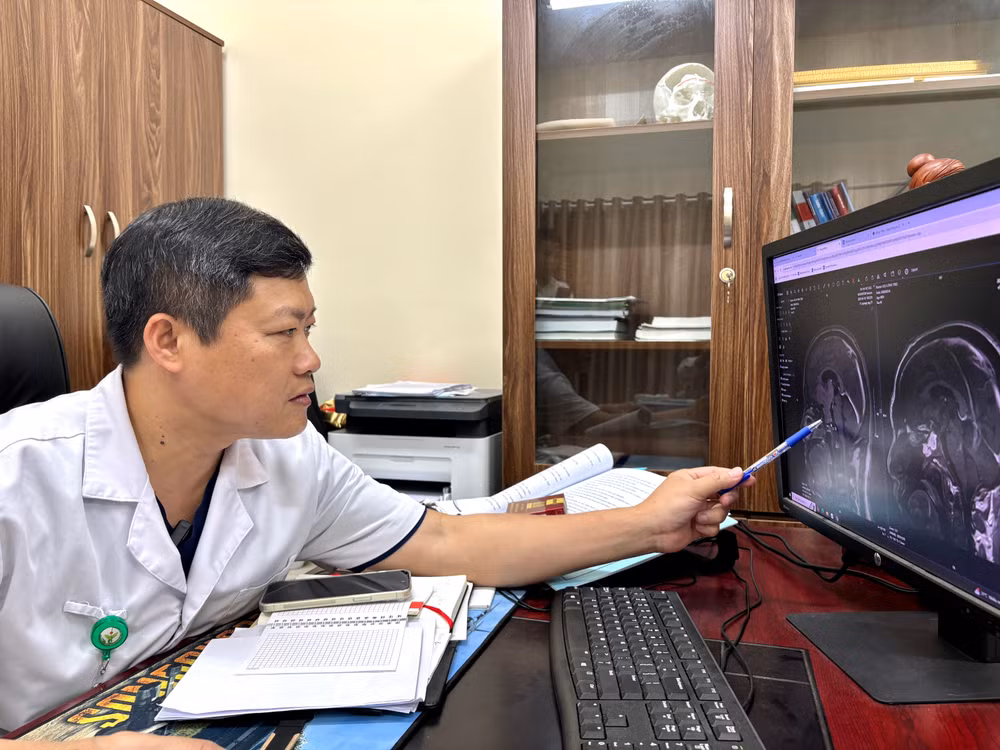 Tiến sĩ, bác sĩ Nguyễn Duy Tuyển, Trưởng khoa Phẫu thuật Thần kinh 2, Bệnh viện Hữu nghị Việt Đức hội chẩn cùng các đồng nghiệp, lựa chọn phương án phẫu thuật tốt nhất cho người bệnh.