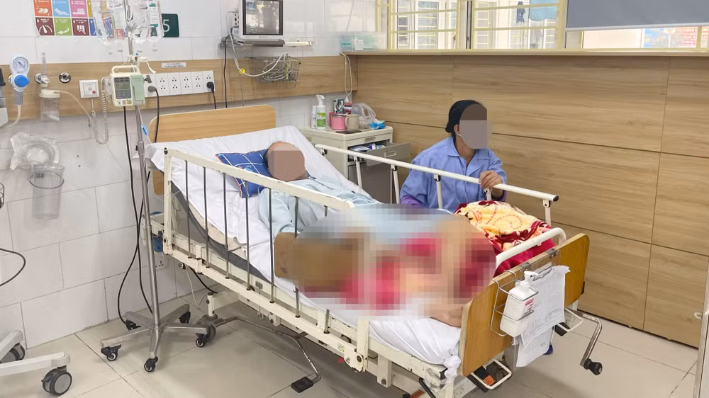 Bệnh nhân đang điều trị tại Bệnh viện Bạch Mai.