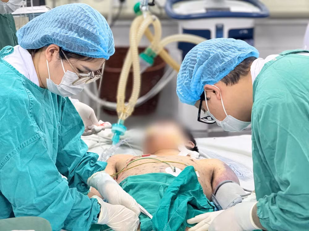 Dù được điều trị tích cực, tình trạng sốc vẫn tiến triển nặng, bác sĩ phải dùng phối hợp hai loại thuốc vận mạch liều cao và đặt ECMO để hỗ trợ tuần hoàn.