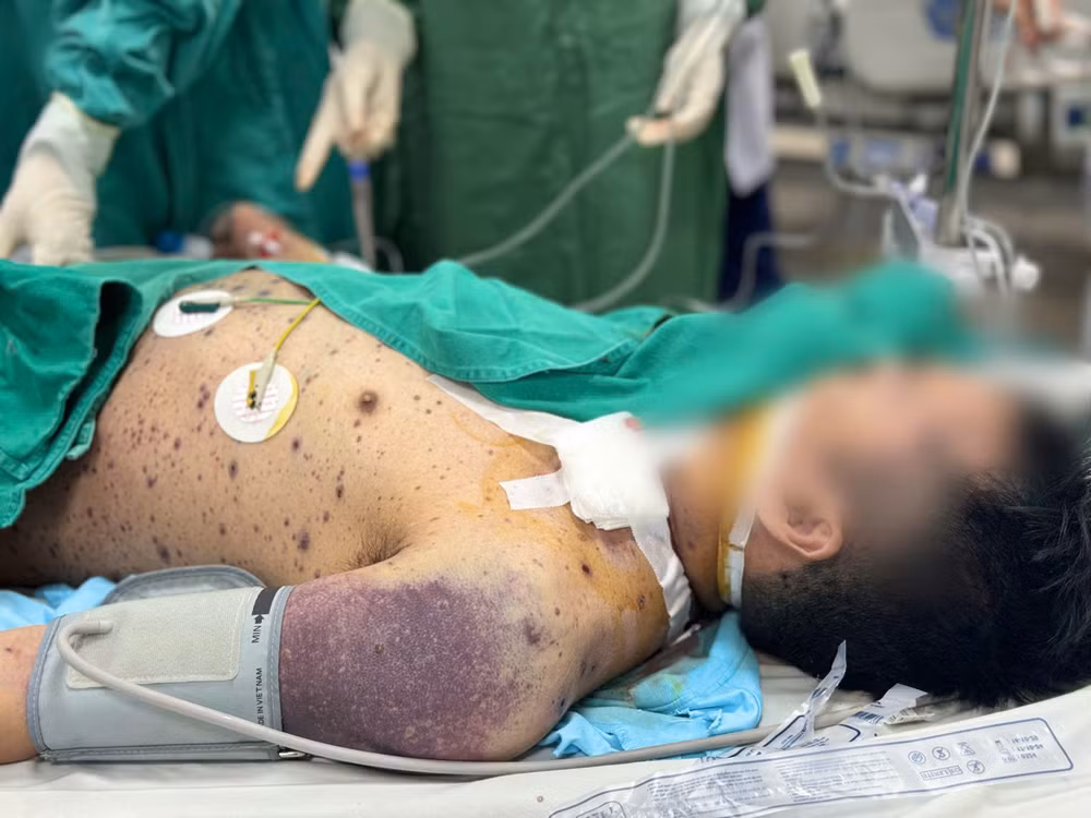 Bệnh nhân có dấu hiệu quan trọng của nhiễm trùng huyết nặng.