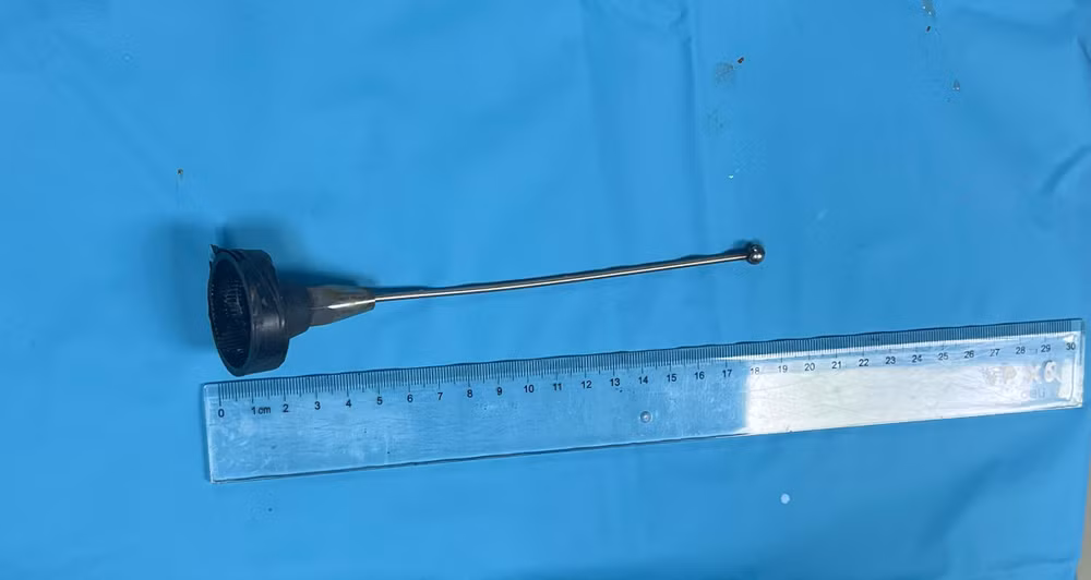 Dị vật gây ra tổn thương cho bệnh nhân. Dị vật gây ra tổn thương cho bệnh nhân.